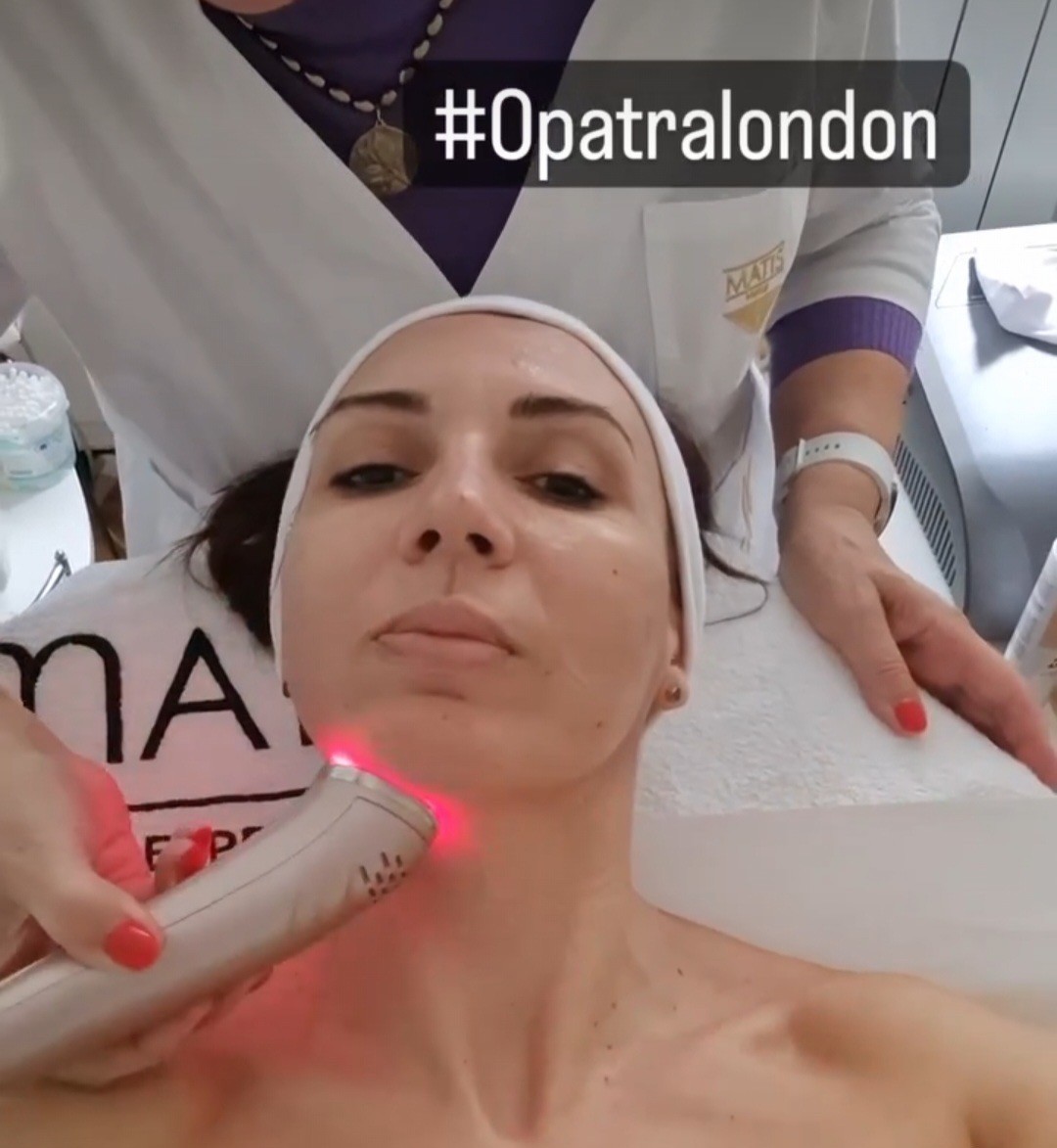 Golden Matis #beograd Tretman lica Tretman Opatra London