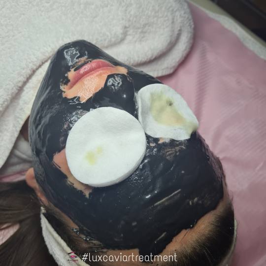 Platinum Beauty Code #beograd Tretman lica