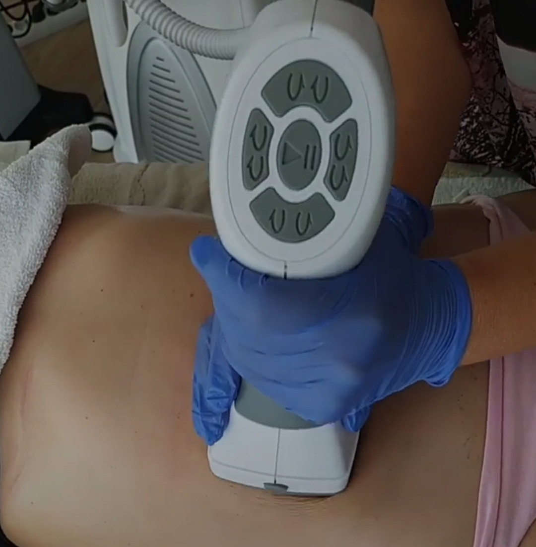21 Beauty Centar #beograd Anticelulit masaža ReShape Body - regija stomaka sa bokovima