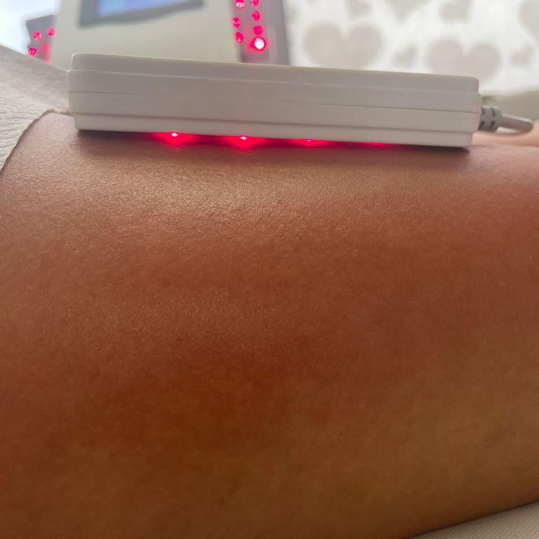 Lipolaser Centar - Matrix021 #novisad Tretmani tela