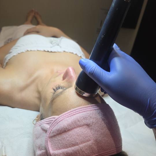 Starmedic #beograd Tretman lica Hidratacija kože - tretman lica