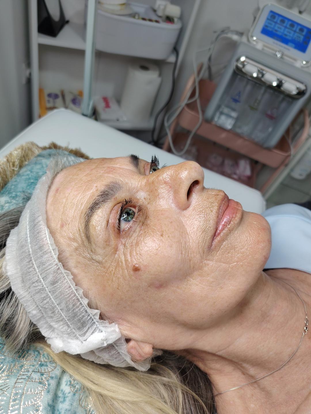 Anti age tretman lica - Kleopatra MS, Trstenik Tretman lica Lice Tretman lica, Trstenik, Centar