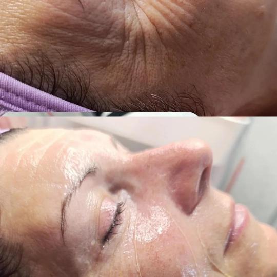 Ceragem Relax usluga