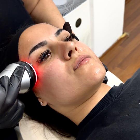 Sophia Style #beograd Tretman lica Čišćenje lica + RF lica + LED photon bio + cold hamer + SPF Li