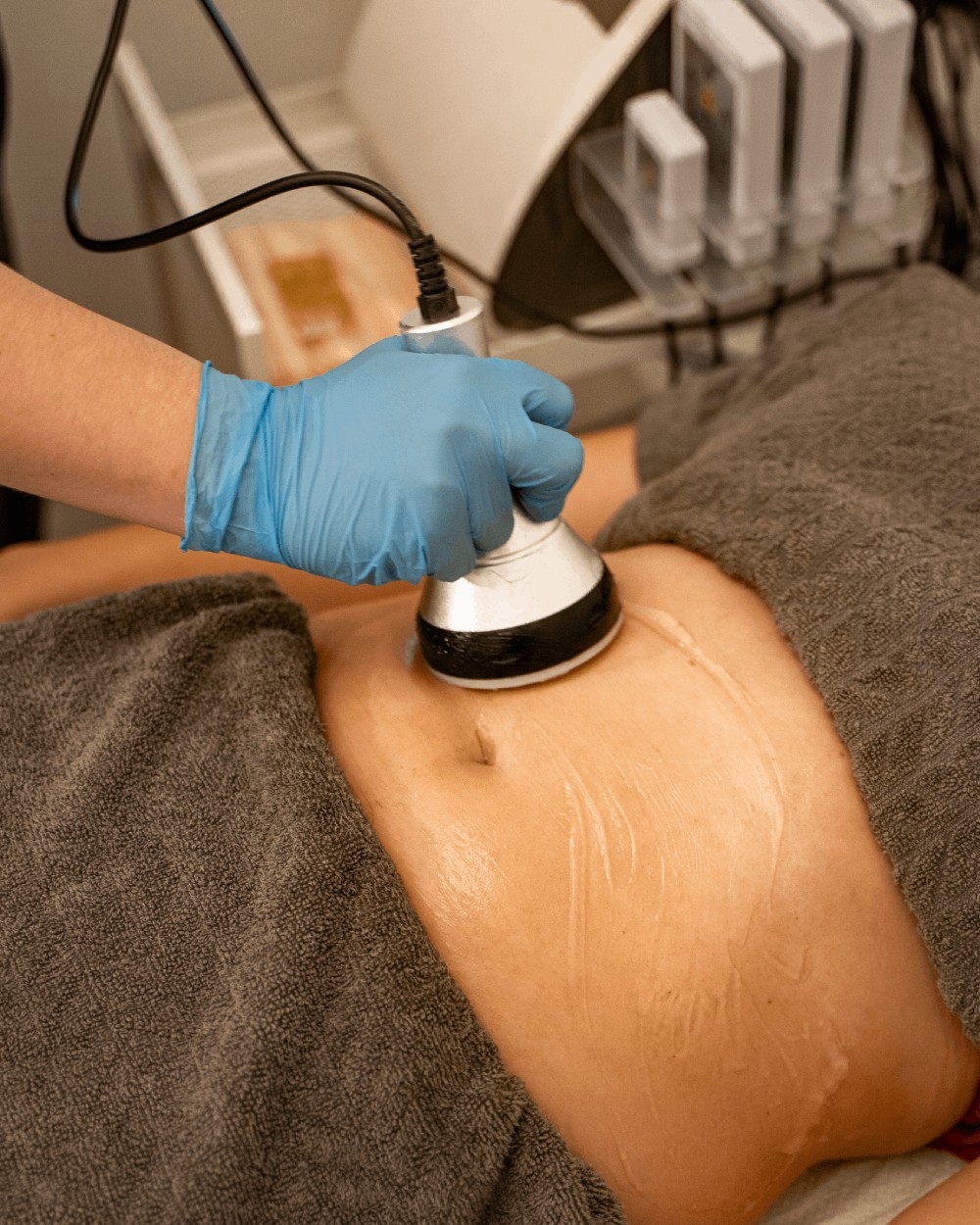 Relax club #beograd Kavitacija Kavitacija tela