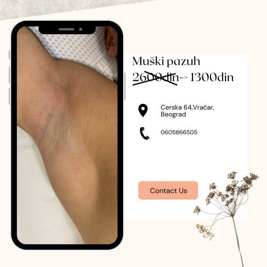 D&D Beauty Center #beograd Laserska epilacija Laserska epilacija pazuha - za muškarce
