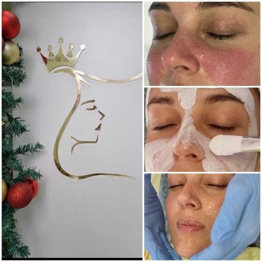 Emilly #beograd Anticelulit masaža Hydra Advanced Ericson Odgovarajućim tretmanima hidratacije dov