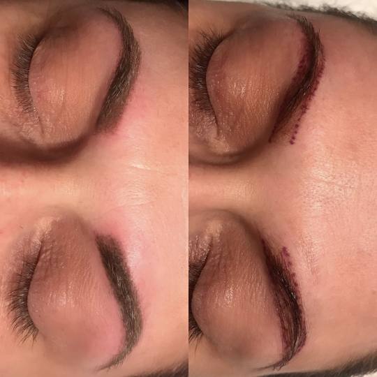 Skinlift Beauty Centar #nis Obrve Puder obrve + prva korekcija do mesec dana