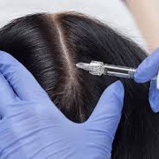 Diva Medical #beograd Tretman rasta kose Hair filer kose