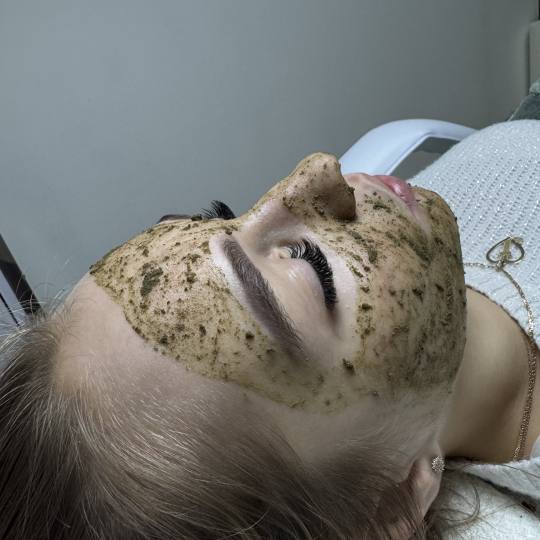 Estetski centar Đina #beograd Tretman lica Fitopiling lica