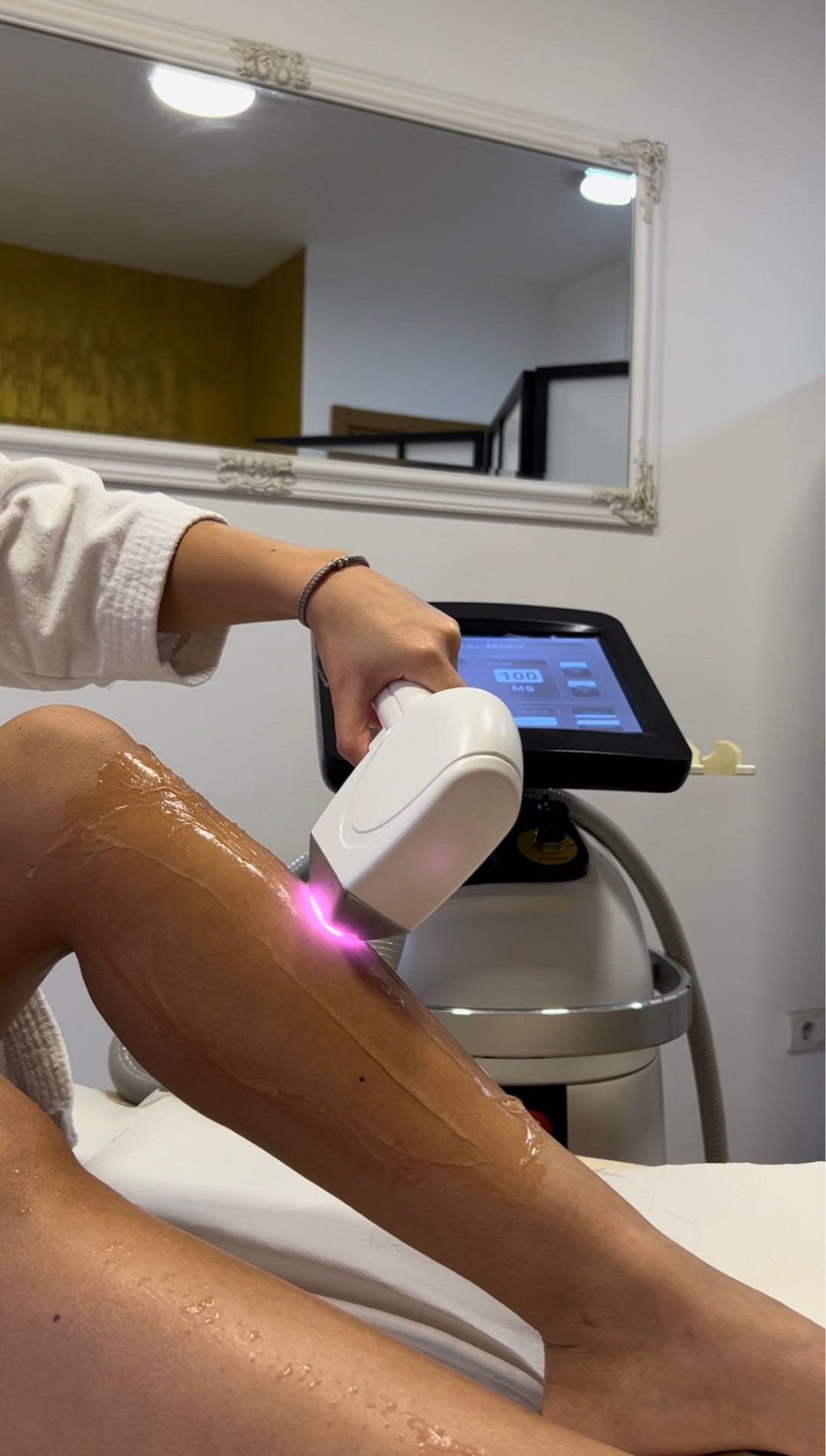 D&D Beauty Center #beograd Laserska epilacija Laserska epilacija celih nogu - za dame