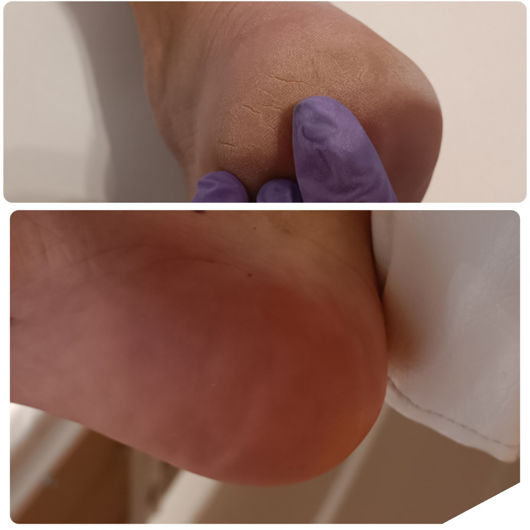Nail Studio MPN #beograd Estetski pedikir