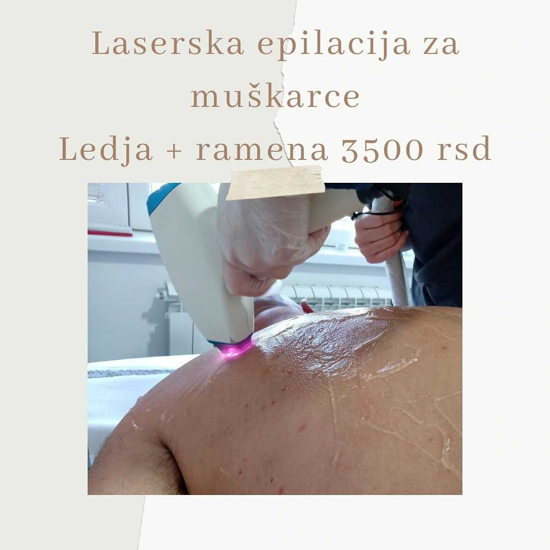 Krasiva #beograd Laserska epilacija Laserska epilacija leđa + ramena - za muškarce