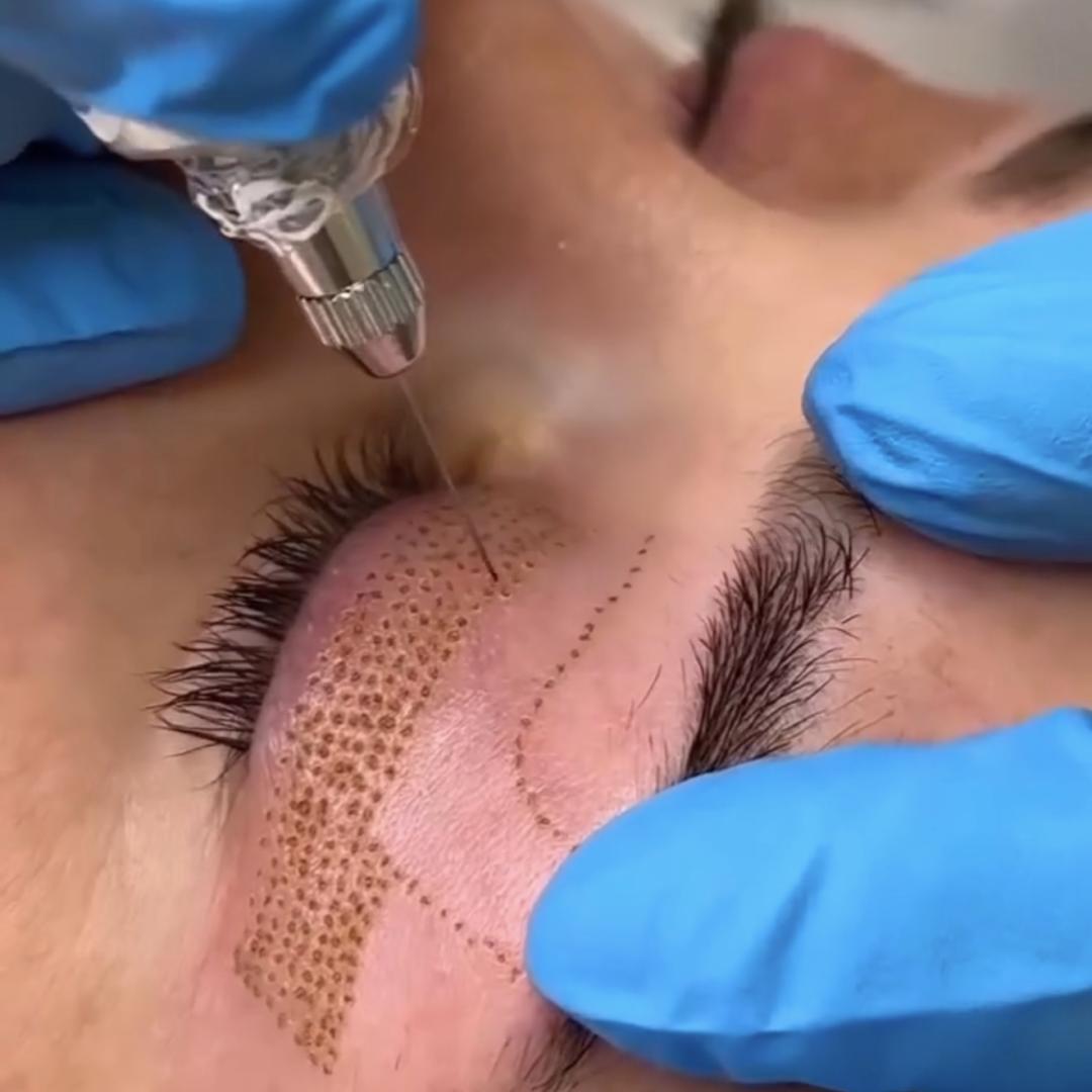 Manja pmu & beauty studio #pancevo Tretman lica Phi-Ion tretman - gornji kapci