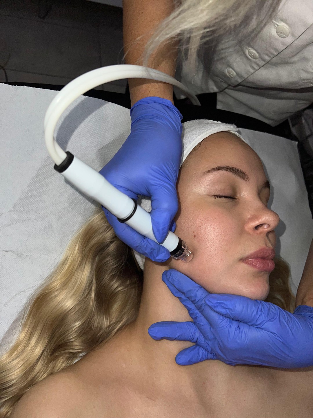 Hydrafacial tretman lica - Laser centar Delight, Beograd Piling lica Lice Piling lica, Beograd, Palilula centralni deo