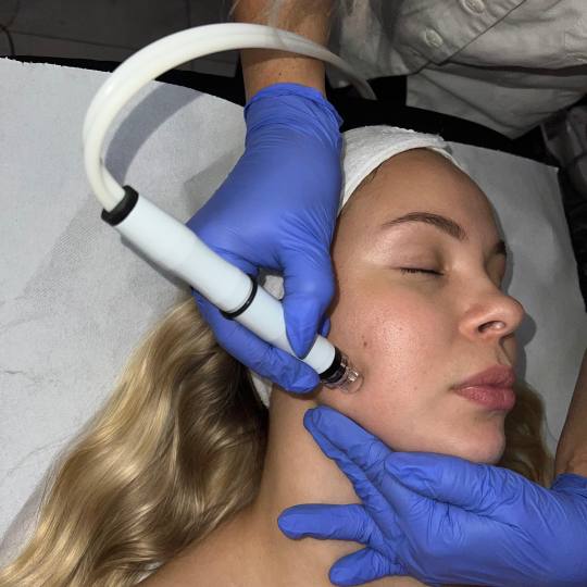 Laser centar Delight #beograd Piling lica Hydrafacial tretman lica HydraFacial ili Hidrodermabrazija