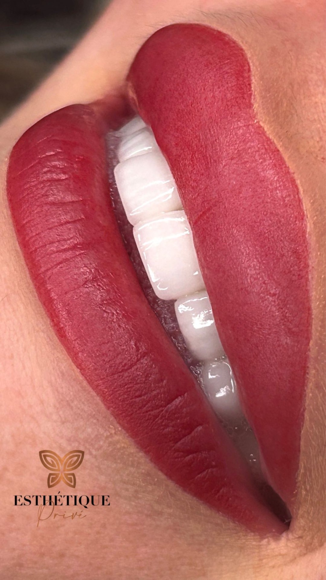 Esthetique Privé #beograd Trajna šminka Trajna šminka usana - PHI LIPPS