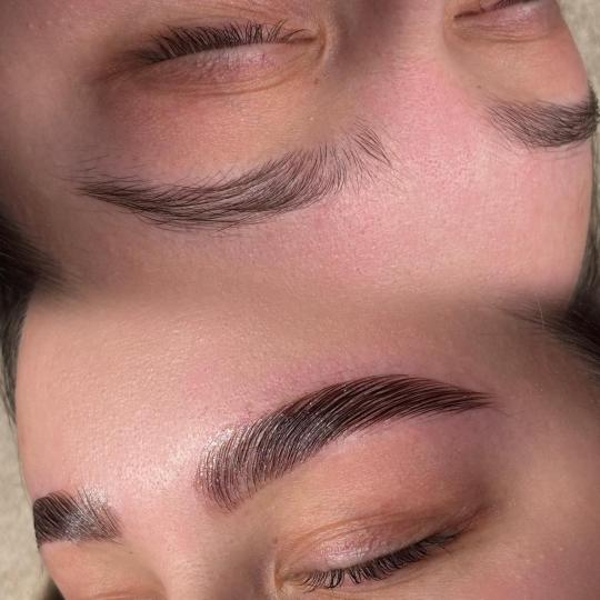 Aora #novisad Obrve Brow lift