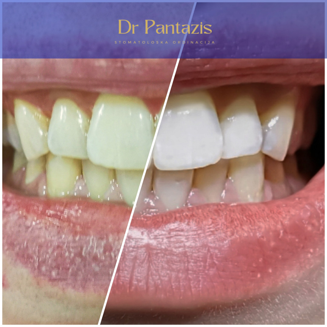 Dr Pantazis - Dental & Beauty Clinic #beograd