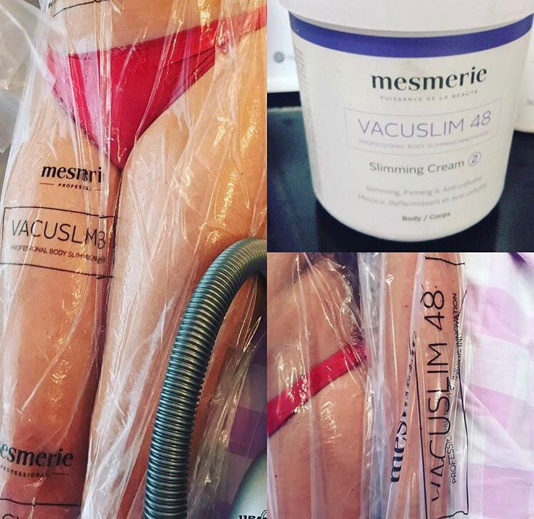 Studio lepote ASM #beograd Tretmani za mršavljenje Vacuslim 48 noge + stomak + ruke - paket od 10 tretmana