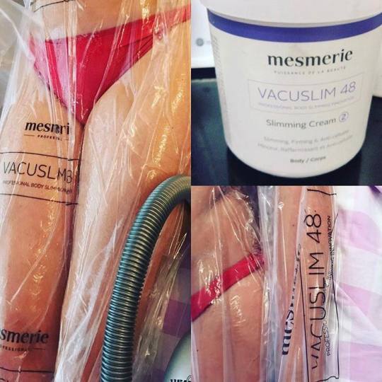 Studio lepote ASM #beograd Tretmani za mršavljenje Vacuslim 48 noge + stomak + ruke - paket od 10 t