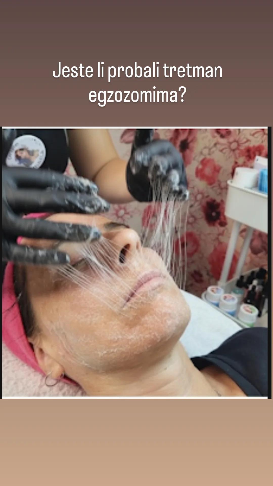 Ceragem Relax #krusevac Tretman lica Egzozomi - lice