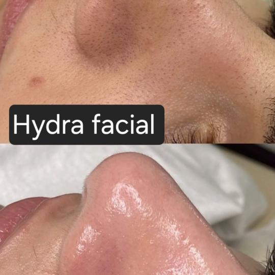 Mila Beauty Centar usluga