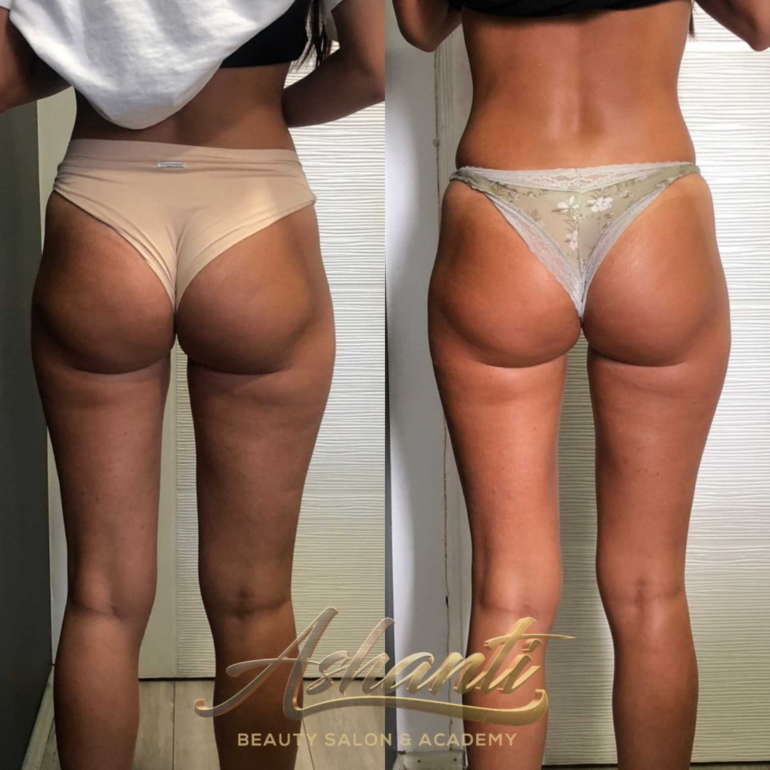 Ashanti Beauty Salon & Academy #beograd Anticelulit masaža