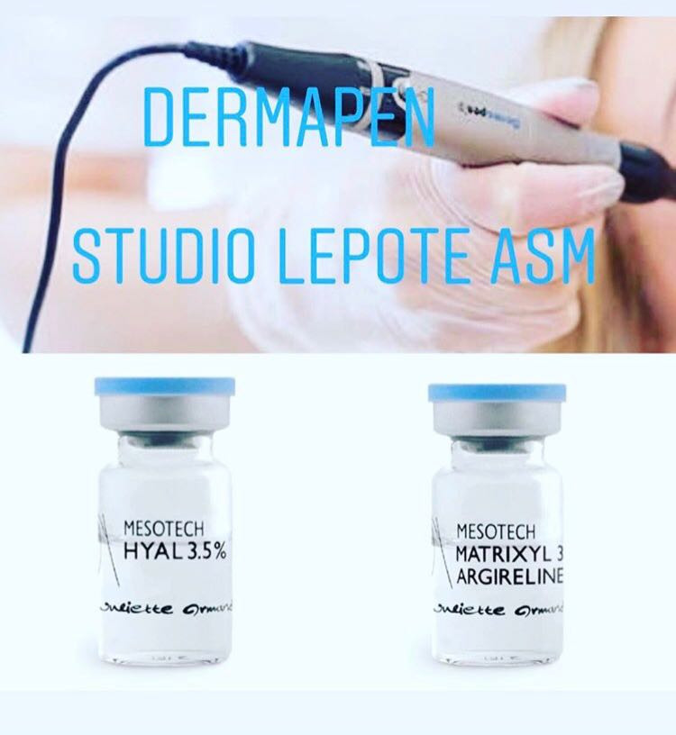 Dermapen tretman - lice - Studio lepote ASM, Beograd Dermaroler i dermapen Lice Dermaroler i dermapen, Beograd, Vračar, Čubura, Crveni krst