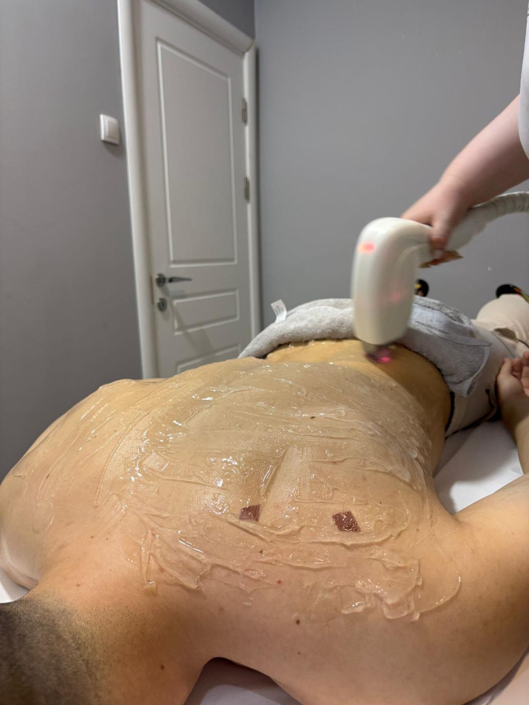 Angels #novisad Tretmani tela Laserska epilacija celog tela - za muškarce