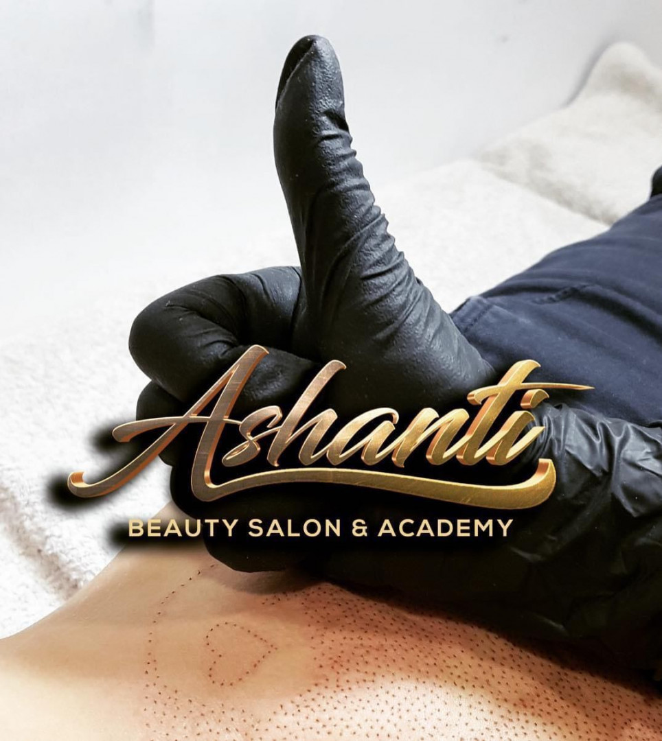 Plasma pen - stomak - Ashanti Beauty Salon & Academy, Beograd Tretman lica Lice Tretman lica, Beograd, Voždovac