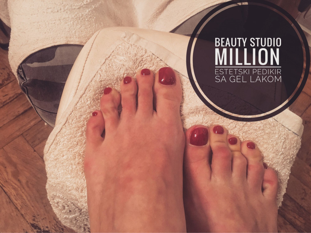 Million #beograd Gel lak