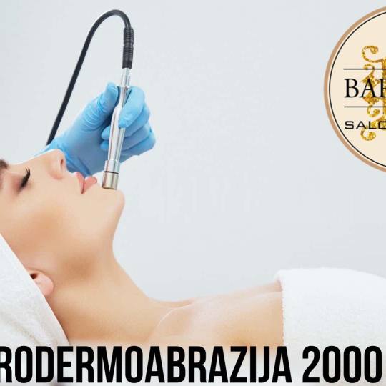Baroque #beograd Mikrodermoabrazija Mikrodermoabrazija lica MIKRODERMOABRAZIJA – kontrolisano odst