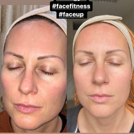 Makeup Olja Grbić #novisad Tretman lica Face gym masaža #masazalica #facegym #facefitness