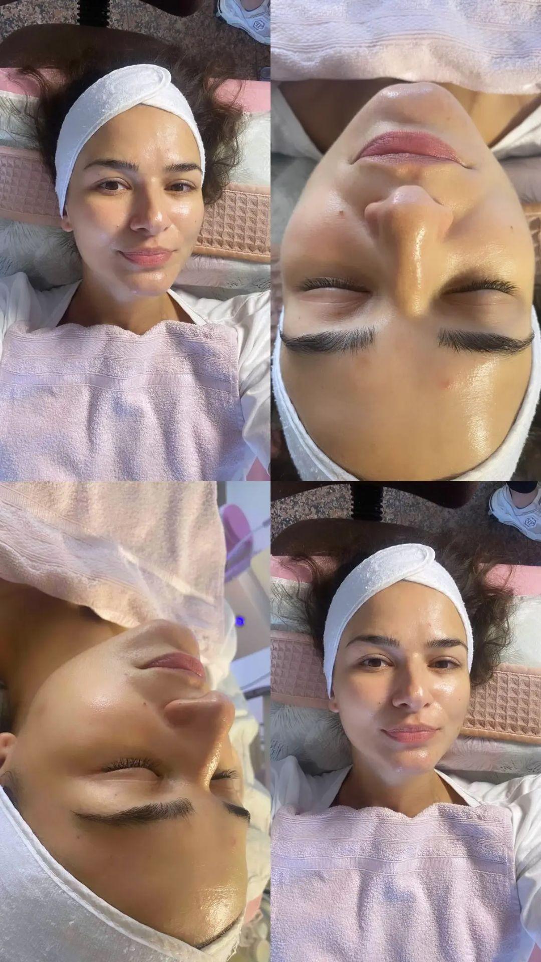 Professional beauty and spa #beograd Radiotalasni i ultrazvučni tretmani Radiotalasni lifting lice + vrat + dekolte