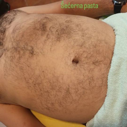 Relax body centar #zajecar Depilacija šećernom pastom Depilacija grudi + stomak šećernom pastom 