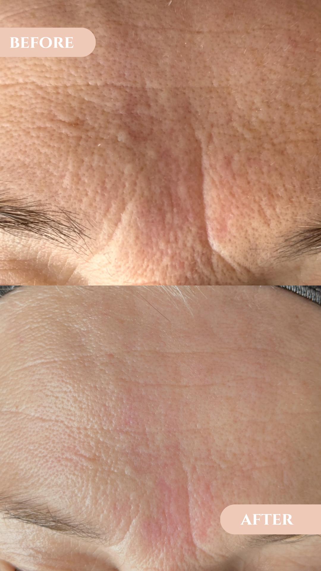 Multi vita - vitaminski antiage tretman 60+ - Lola esthetic center, Beograd Tretman lica Lice Tretman lica, Beograd, Novi Beograd blokovi, Belville, Savski kej