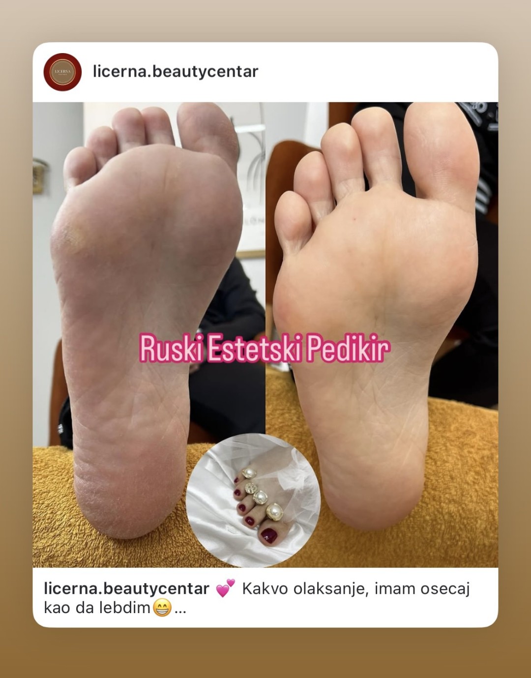 Licerna Beauty Centar #novisad