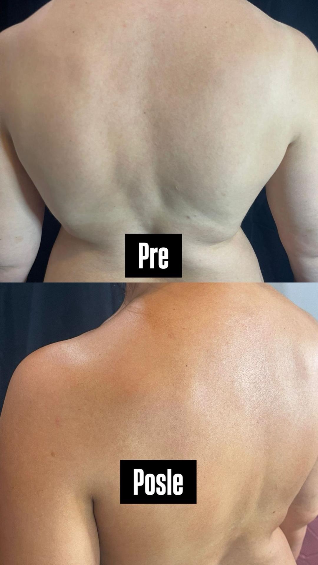 Sprej ten samopotamnjivanje - celo telo - Lume Beauty, Beograd Air brush potamnjivanje kože Telo Air brush potamnjivanje kože, Beograd, Zvezdara