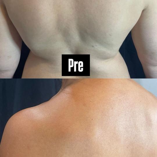 Lume Beauty #beograd Air brush potamnjivanje kože Sprej ten samopotamnjivanje - celo telo