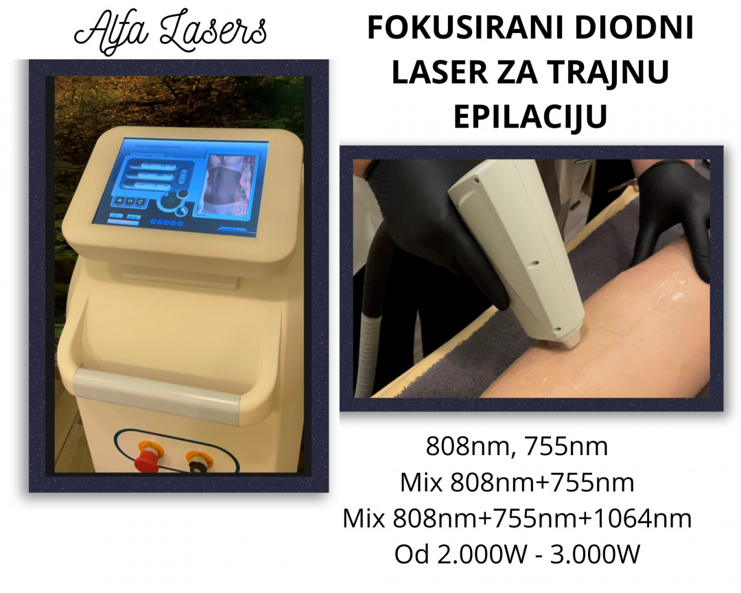 Kalina Beauty #beograd Laserska epilacija Laserska epilacija celog tela - za dame