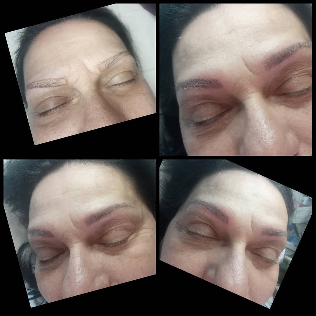 Derma Life #beograd Obrve