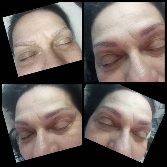Derma Life #beograd Obrve ubotu za Giorgi-a, radno vreme 13-17h.