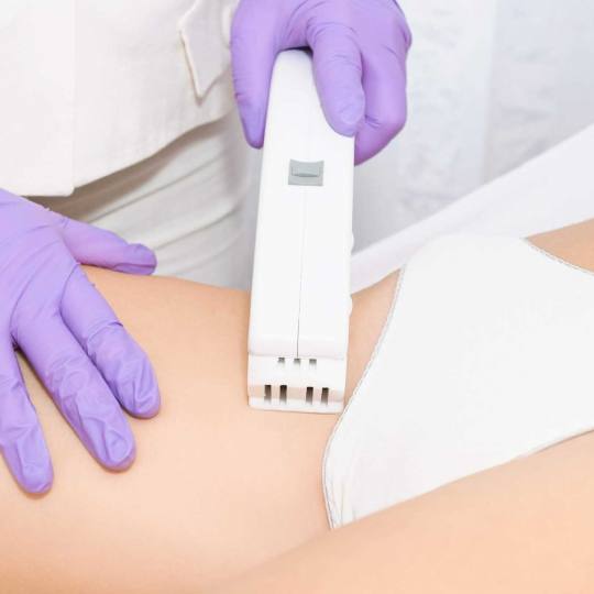 Estetik Studio Lira #beograd Epilacija IPL aparatom Epilacija plitkih prepona - za dame Epilacija pr