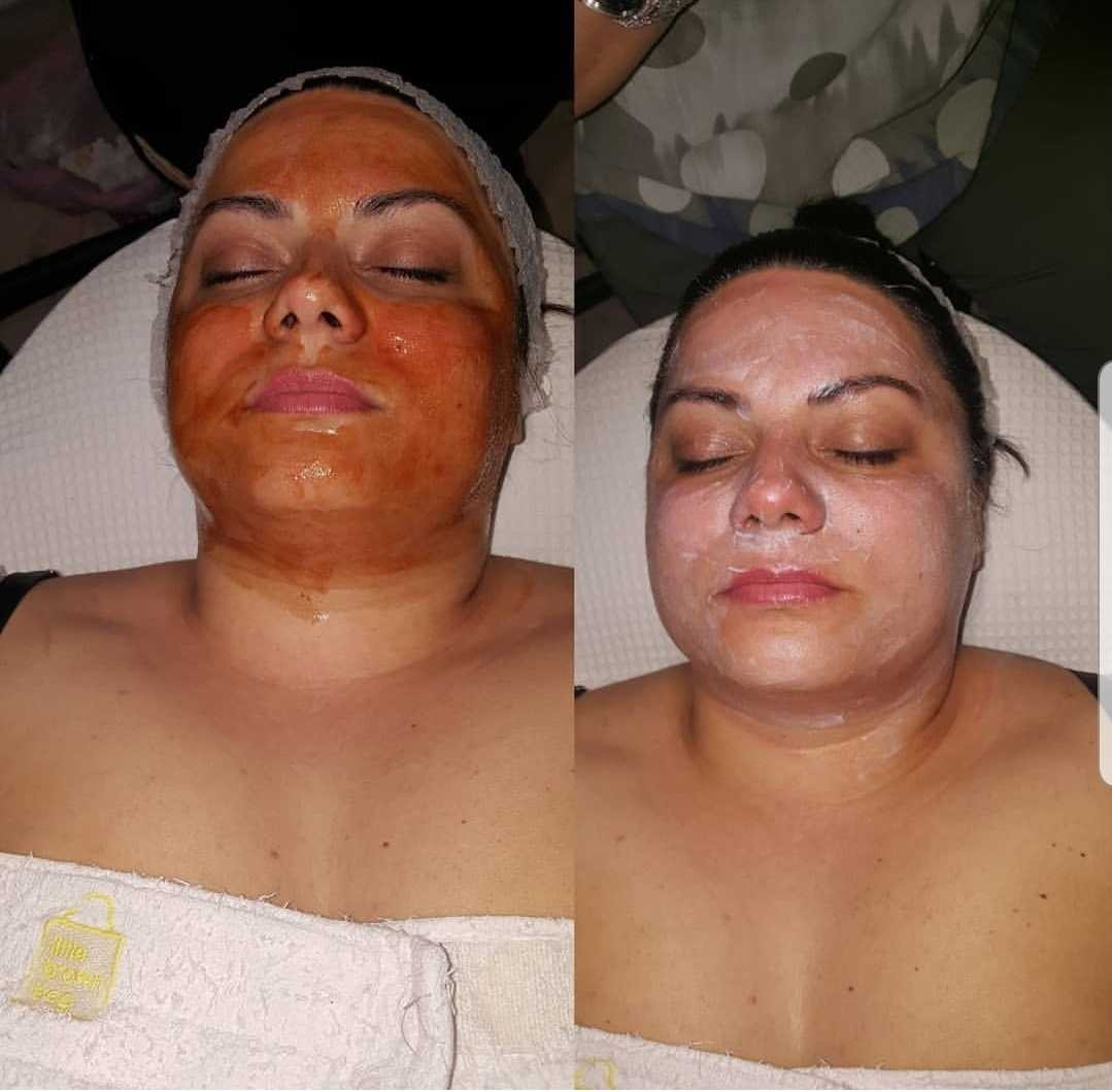 Grossi cosmetic #beograd Tretman lica