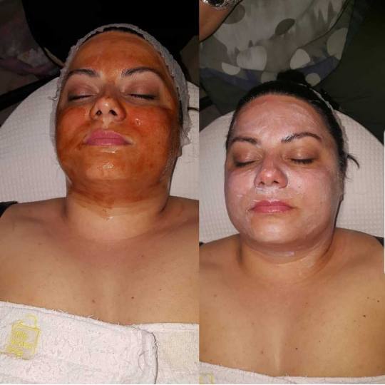 Grossi cosmetic #beograd Tretman lica