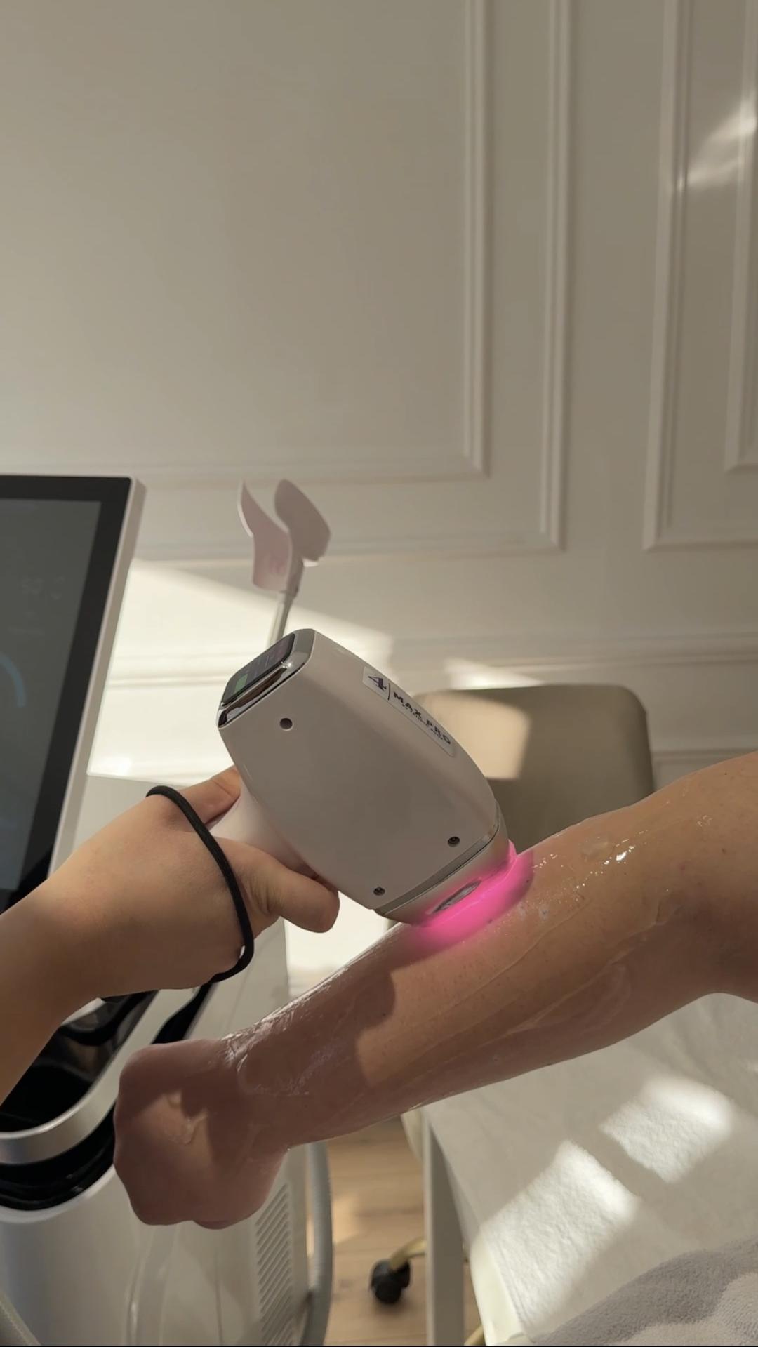 Lola esthetic center #beograd Laserska epilacija Laserska epilacija pazuh + ruke - za dame