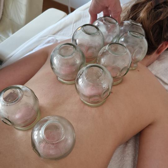 Glow Holistic Studio #beograd Anticelulit Cupping tretman - ventuze 60 min Cupping masaža - terapij