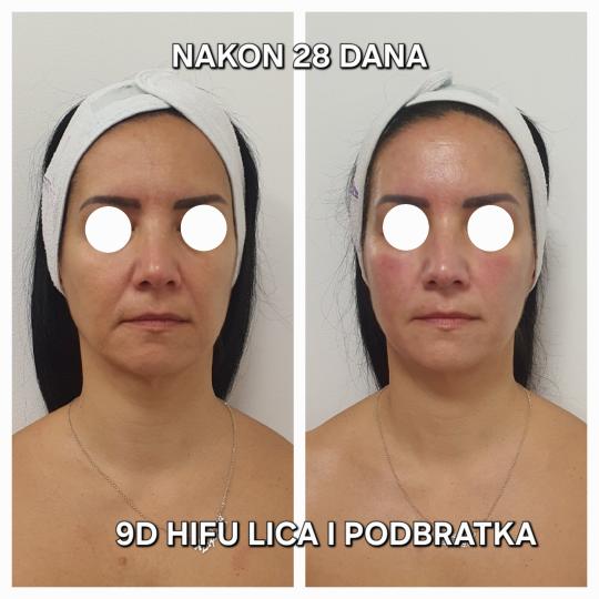 Beauty Vreme za mene usluga