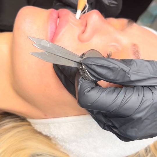 Esthetique Privé #beograd Trajna šminka Trajna šminka usana - PHILIPPS